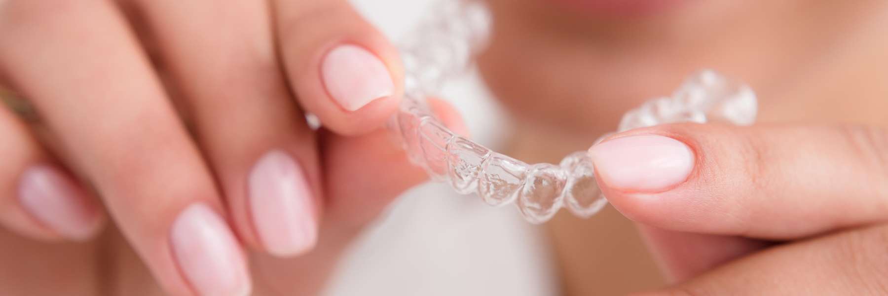 Invisalign | Dentist